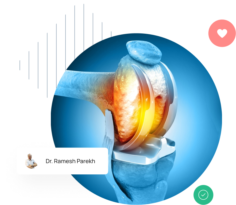 Dr. Ramesh Parekh (Head of general surgery) provide knee replacement treatment services with a 360-degree approach and surgical precision with advanced robotics.